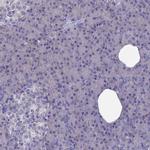 Adenylate Kinase 4 Antibody in Immunohistochemistry (IHC)