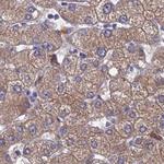 Adenylate Kinase 4 Antibody in Immunohistochemistry (IHC)