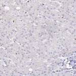 DENND1C Antibody in Immunohistochemistry (IHC)