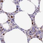 DENND1C Antibody in Immunohistochemistry (IHC)