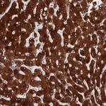 PPP2R2D Antibody in Immunohistochemistry (IHC)