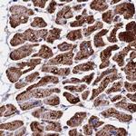 ATP5H Antibody in Immunohistochemistry (IHC)