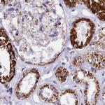 ATP5H Antibody in Immunohistochemistry (IHC)