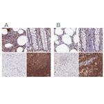 DENND1C Antibody in Immunohistochemistry (IHC)