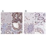 SF3A2 Antibody in Immunohistochemistry (IHC)