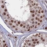 SF3A2 Antibody in Immunohistochemistry (IHC)