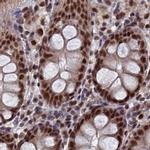 SF3A2 Antibody in Immunohistochemistry (IHC)