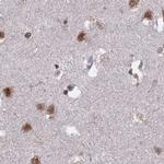 SF3A2 Antibody in Immunohistochemistry (IHC)