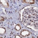 SF3A2 Antibody in Immunohistochemistry (IHC)