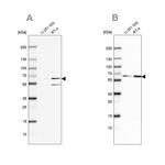 SF3A2 Antibody in Western Blot (WB)