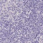 CHMP5 Antibody in Immunohistochemistry (IHC)