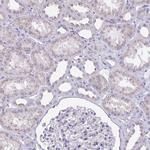 CHMP5 Antibody in Immunohistochemistry (IHC)