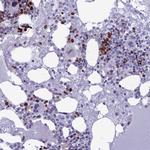 NUSAP1 Antibody in Immunohistochemistry (IHC)