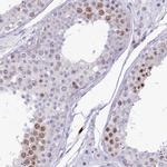 NUSAP1 Antibody in Immunohistochemistry (IHC)