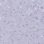 NUSAP1 Antibody in Immunohistochemistry (IHC)