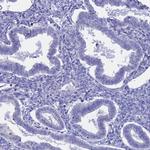 GLB1L Antibody in Immunohistochemistry (IHC)