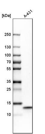 UQCRB Antibody in Western Blot (WB)