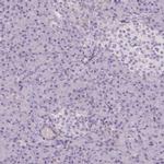 SLC6A19 Antibody in Immunohistochemistry (IHC)