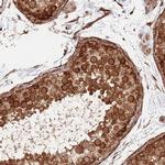 NEK3 Antibody in Immunohistochemistry (IHC)