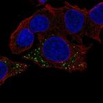 HBB Antibody in Immunocytochemistry (ICC/IF)