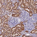 GCDH Antibody in Immunohistochemistry (IHC)