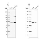 GCDH Antibody in Western Blot (WB)