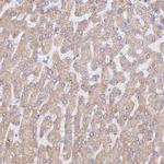 WDR62 Antibody in Immunohistochemistry (IHC)