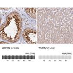 WDR62 Antibody