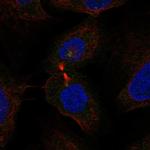 WDR62 Antibody in Immunocytochemistry (ICC/IF)