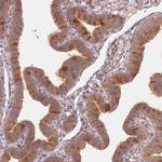 WDR54 Antibody in Immunohistochemistry (IHC)