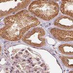 WDR54 Antibody in Immunohistochemistry (IHC)