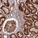 EARS2 Antibody in Immunohistochemistry (IHC)