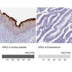UPK2 Antibody in Immunohistochemistry (IHC)