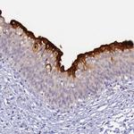 UPK2 Antibody in Immunohistochemistry (IHC)