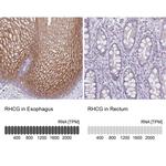 RHCG Antibody in Immunohistochemistry (IHC)