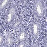 TBC1D21 Antibody in Immunohistochemistry (IHC)