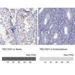 TBC1D21 Antibody