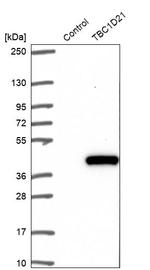 TBC1D21 Antibody in Western Blot (WB)