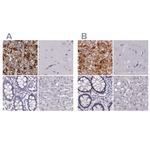 PNMT Antibody in Immunohistochemistry (IHC)