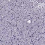 PNMT Antibody in Immunohistochemistry (IHC)