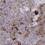 PNMT Antibody in Immunohistochemistry (IHC)