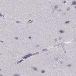 PNMT Antibody in Immunohistochemistry (IHC)