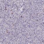 RASAL3 Antibody in Immunohistochemistry (IHC)