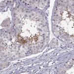 ACSBG2 Antibody in Immunohistochemistry (IHC)