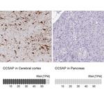 C1orf96 Antibody in Immunohistochemistry (IHC)