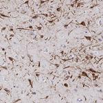 C1orf96 Antibody in Immunohistochemistry (IHC)