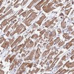 MRPS9 Antibody in Immunohistochemistry (IHC)