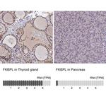 FKBPL Antibody in Immunohistochemistry (IHC)