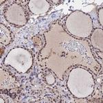 FKBPL Antibody in Immunohistochemistry (IHC)