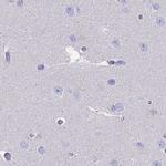 CYP51A1 Antibody in Immunohistochemistry (IHC)